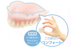 denture_img001