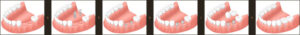 implant_img007