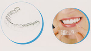 orthodontic_img001