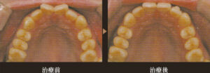orthodontic_img003