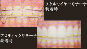 orthodontic_img004