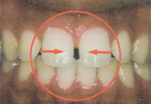 orthodontic_img005