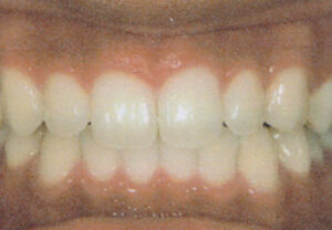orthodontic_img006