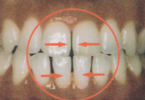 orthodontic_img007