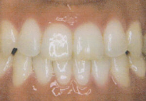 orthodontic_img008