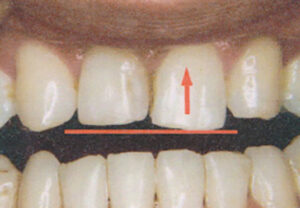 orthodontic_img009