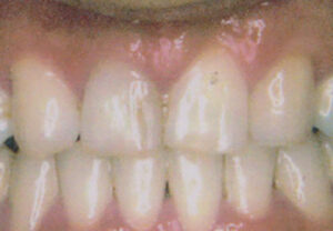 orthodontic_img010
