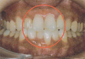 orthodontic_img013