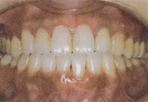 orthodontic_img014