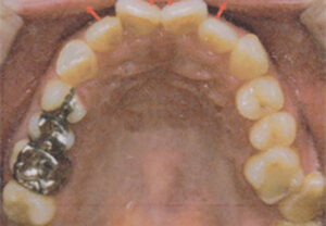orthodontic_img015