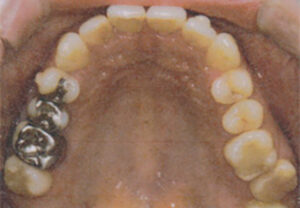orthodontic_img016